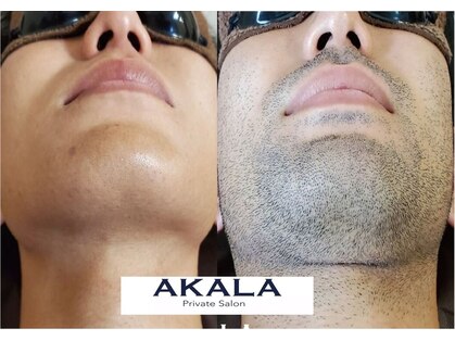 アカラ 読谷店(AKALA)の写真