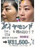 韓国発！ダイヤモンドピール★シミケア・跡残りニキビケア★