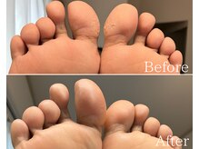 カシェット 広島店(Cachette)/30代女性☆足裏角質ケア90分