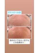 ノフ 恵比寿(noff)/bf/af【ダクトピール】