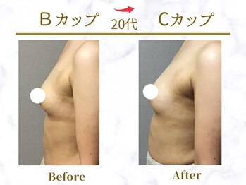 Ms.やまとなでしこ/ビフォーアフター