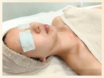 ソウナ(SONA)/ハーブピーリングスペシャル3