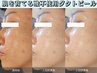 【結果重視◆シミたるみ改善】ダクトピール×高濃度美容液導入×ヘッドスパ
