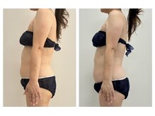 ミルティー(Myrtille)/リンパ解放でスッキリボディへ