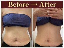 クオレ(CUORE)/ビフォーアフター