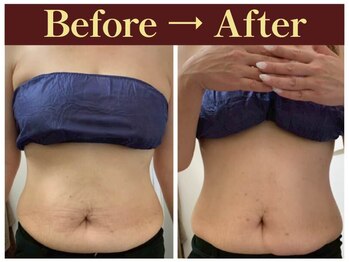 クオレ(CUORE)/ビフォーアフター