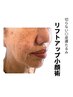 【40分で劇的変化】二重顎・たるみ改善◆サーモシェイプ小顔Deep(残3)