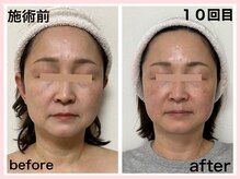 ダルセーニョ/◎５０代...鏡が映した現実！◎