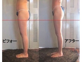 痩身 セル脂肪専門 スタイルデザイン/2022ベストボディSD★総合優勝2