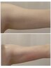 【大人気！二の腕・ハミ肉】脂肪燃焼５ml＋セルゼロ