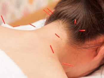 ソレイユ麻布鍼灸整体院の写真/【完全個室/麻布十番徒歩3分】辛い首コリ・肩コリ/姿勢改善≪国家資格施術者◎鍼灸×整体マッサージ≫