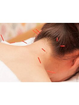 首・肩のつらさを改善したい