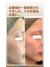 リズ(Liz)/ピュールボーテは凄い