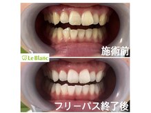 ルブラン 奈良店(Le Blanc)/通いやすいサロン！！