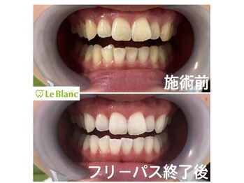 ルブラン 奈良店(Le Blanc)/通いやすいサロン!!