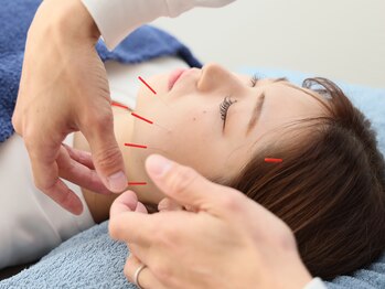 ウノ鍼灸院(uno鍼灸院)