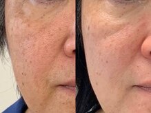 サクラ 伊勢原店(SAKURA)/エステ以上の効果を専門店の強み