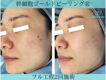 リメイク 広尾(REMAKE)/