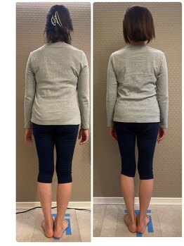 アリィ(Alii)/見た目だけでなく肩こりも楽に