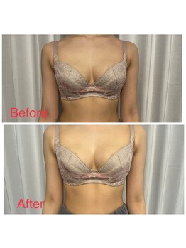 ポワトリーヌ ベル 三鷹店の写真/憧れのボリューム感とスタイルよく見える仕上がりを短期集中で！自信あふれる私へ◎