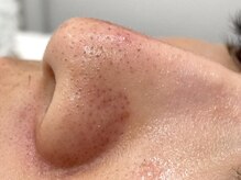 ウェクシー(WECXII)/