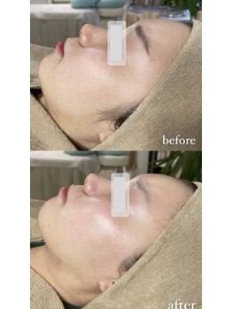 ミーミドットアイ(Mi-mi.i)/美しい肌を手に入れれる艶肌Wax