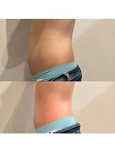 アンバー(amber)/ポッコリお腹引締めサイズダウン