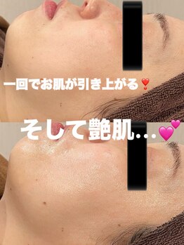 ツール(TOOL)/ハーブピーリング