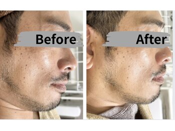 マリア(MALIA)/大阪天満宮◆小顔×横顔補正