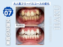 ハク 袋井磐田店(HAKU)/お客様before→after 7