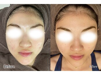 アネル 豊見城(anel)/