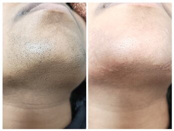 ヌケッタ 池袋の写真/【国際ライセンス保持者在籍!】理想の眉やヒゲ、白髪ケア!お試し3300円~◆プロが1ミリ単位で調整します◎