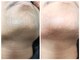 ヌケッタ 池袋の写真/【国際ライセンス保持者在籍!】理想の眉やヒゲ、白髪ケア!お試し3300円~◆プロが1ミリ単位で調整します◎
