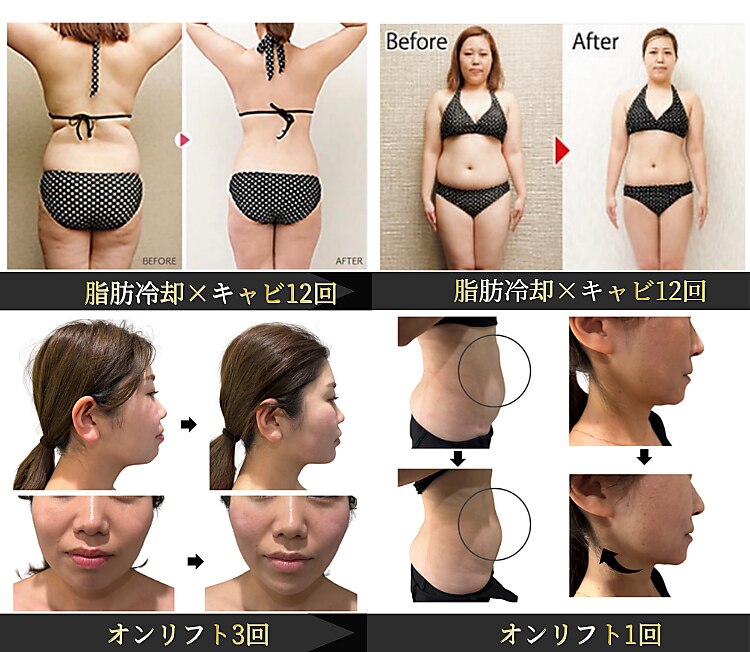 ソラ 小倉(SORA)｜ホットペッパービューティー