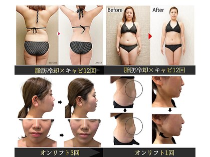 ソラ 小倉(SORA)の写真