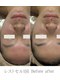 エソール(essor)の写真/毛穴洗浄×小顔ケアで透明感アップ！大人女性の肌悩みに応える結果重視の肌質改善フェイシャル専門サロン