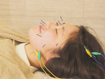 ナルビス(Nalbis)の写真