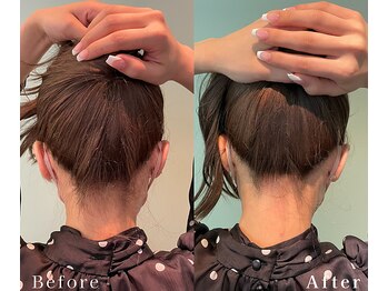 リノ(Lino)/うなじ脱毛