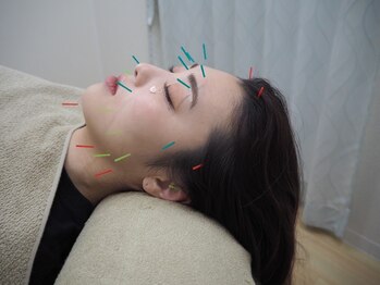 七つ葉鍼灸接骨院/自律神経調整美容鍼！