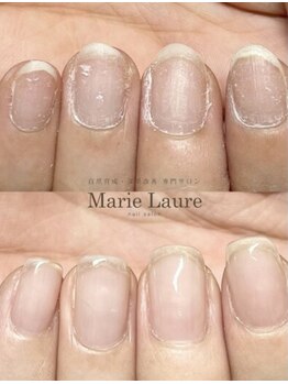 マリーロール 天王寺店(Marie Laure)/自爪育成/深爪矯正/ネイルケア