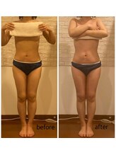 うつくし痩身 美サロン ゼットワン(Z-ONE)/ボディ　メディセル＋マッサージ