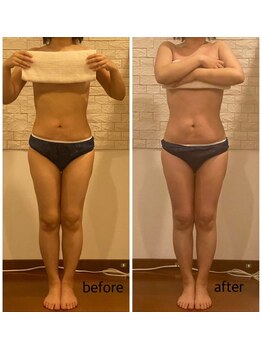 うつくし痩身 美サロン ゼットワン(Z-ONE)/ボディ　メディセル＋マッサージ