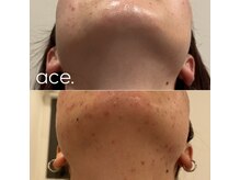 エース チガサキ(ace. CHIGASAKI)の雰囲気（根本改善を目標に、日常生活などのカウンセリングを重視します。）