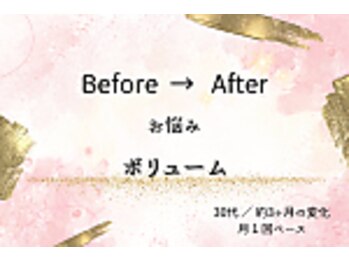 ロットプラス(Lot Plus)/Before→After【30代のお客様】