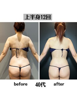 グラチア(Gratiae)/