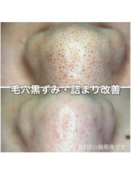 ウェリナ(Welina)/