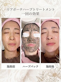 ブリスルーチェ(Bliss luce)の写真/【脱・隠す肌】ファンデーションを卒業したいあなたへ贈る、至高の肌質改善プログラム