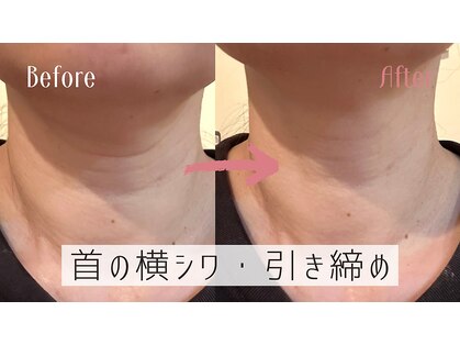 シベール(Si belle)の写真