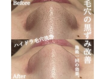 ファースト(1st)