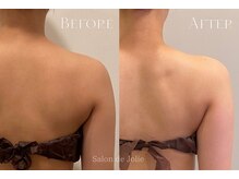 サロンドジョリー(Salon de Jolie)/【ボディウィンバック】